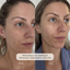 Enzyme Peel Face Mask
