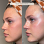 Before and after comparison of a person's face with skin tone, texture, and hydration improvement.